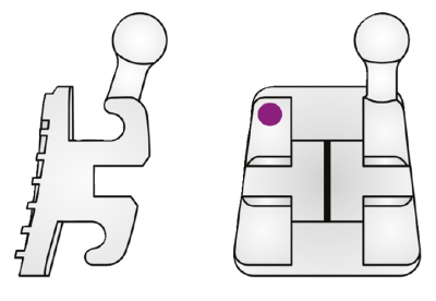 .022 Elite Opti-MIM Mini Twin 14/15 Qty. 10